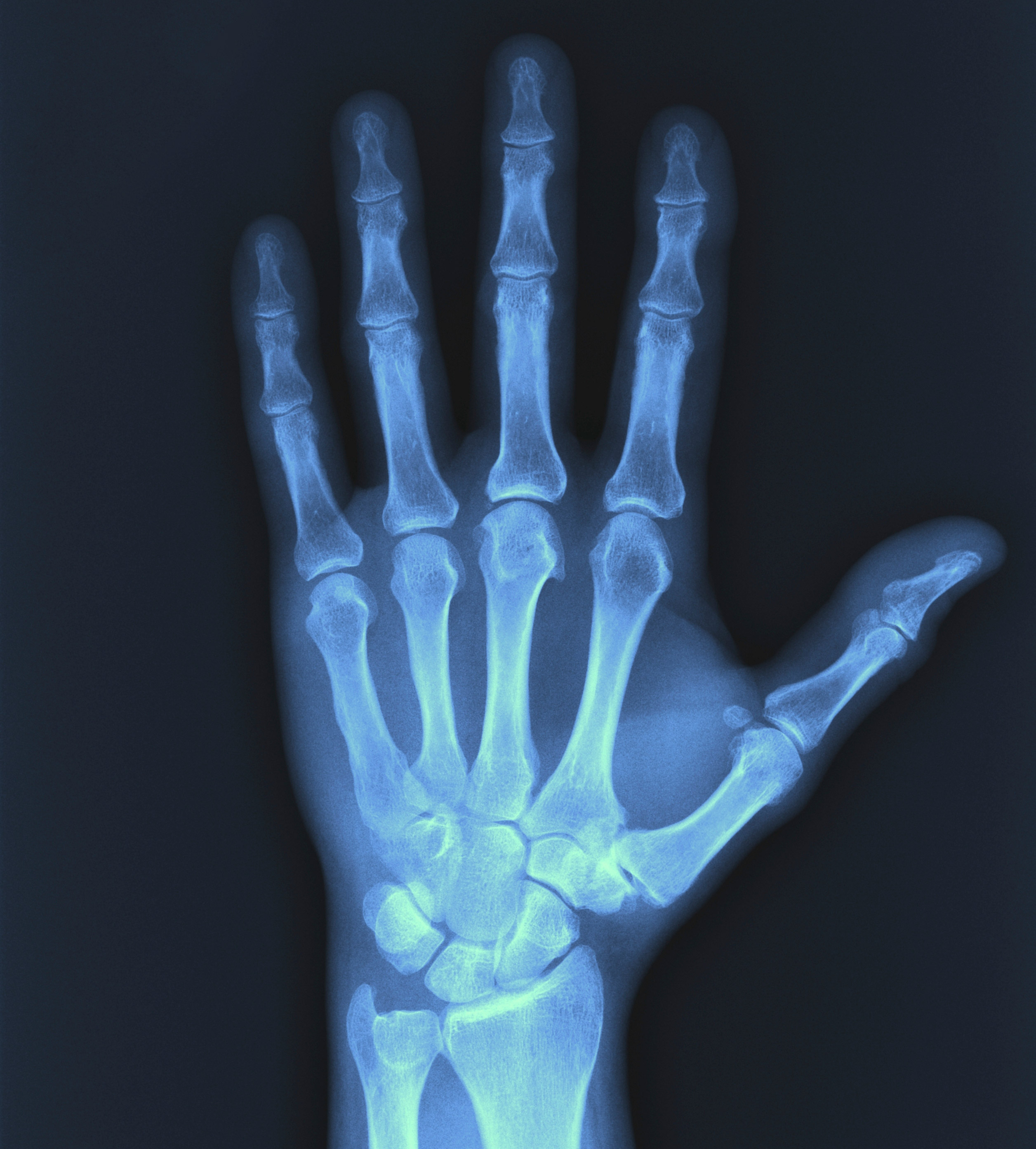Photo of X-Ray Cihazının Zararları